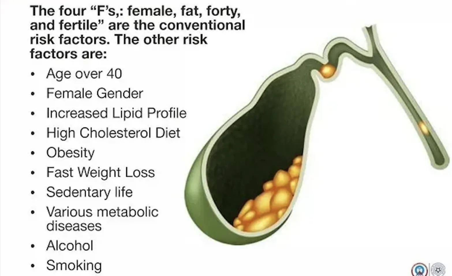 पित्तथैलीमा ढुंगा (Gallstone): लक्षण, मिथक, उपचार र शल्यक्रिया पछि हेरचाह